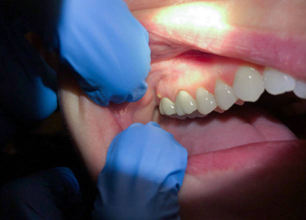 Best Emergency Dental Care for Trauma or Injury in Penngrove, CA